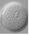 Perossisoma