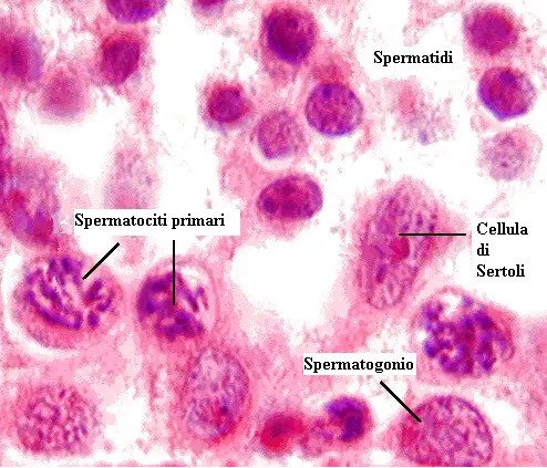 spermatogonio