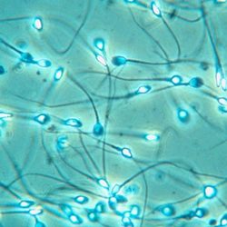 spermatozoi-seme-umano