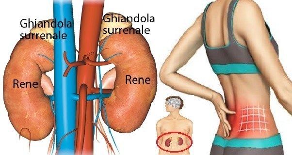 surrene