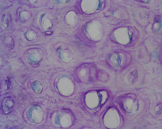 cartilagine