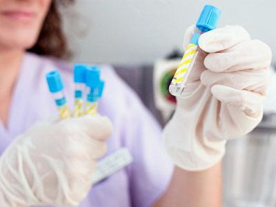 immunoprofilassi