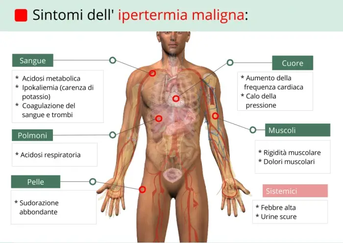 sintomi-ipertermia-maligna_7