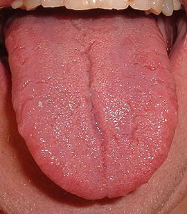 lingua
