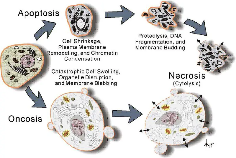 oncosi-necrosi