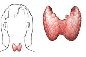 tiroide