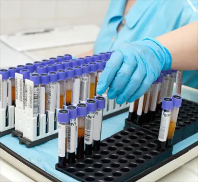 ves-esami-laboratorio