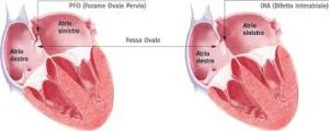 atri-cardiaci