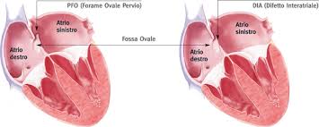 atri-cardiaci