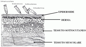 parenterale
