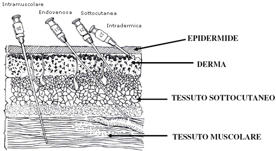 parenterale