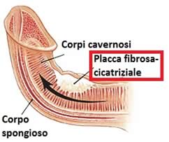 dolore-al-pene