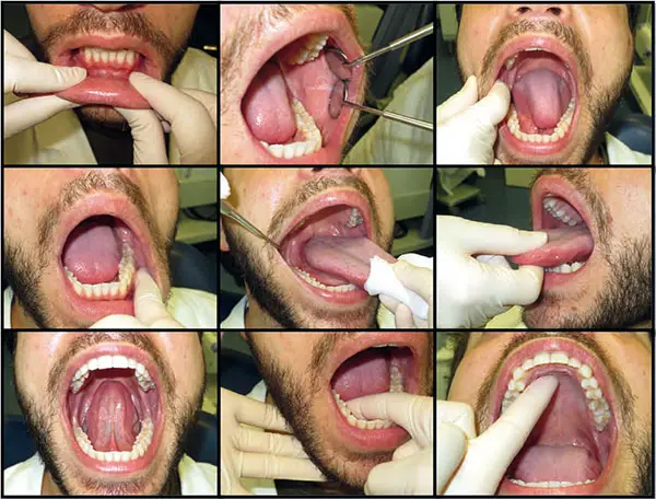 odontogena
