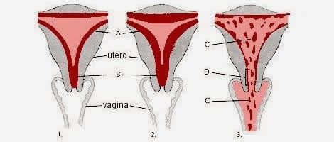 menorrea