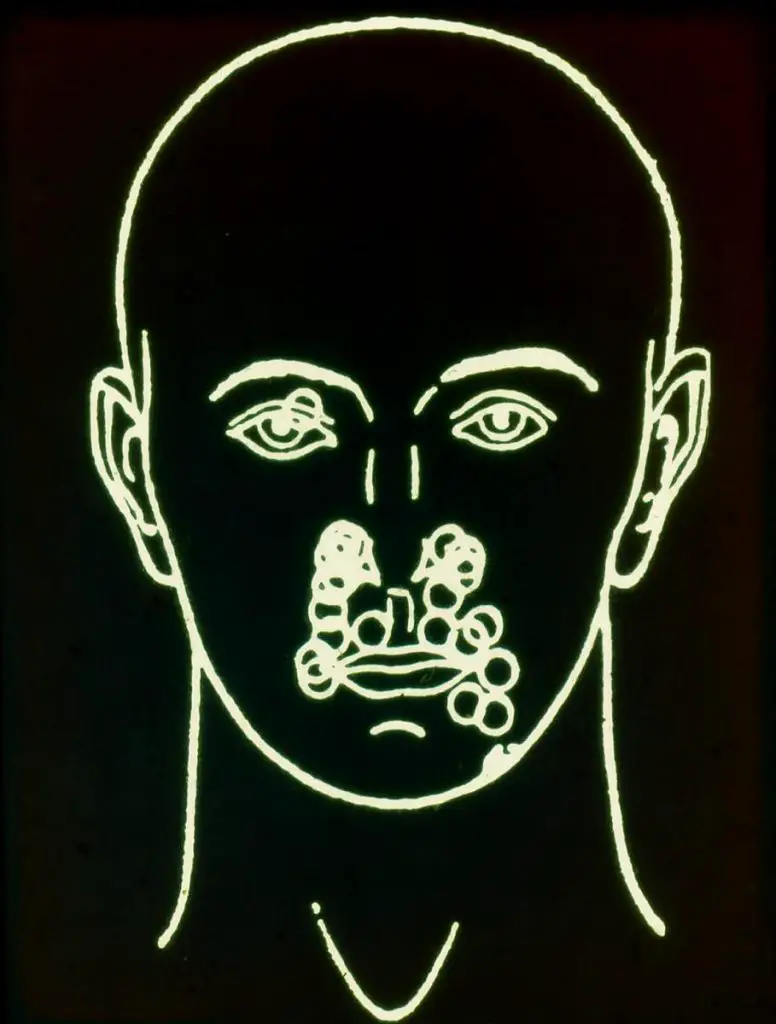 trigemino